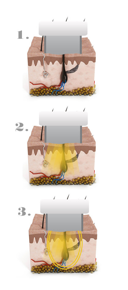 sistemas_ipl_punteros